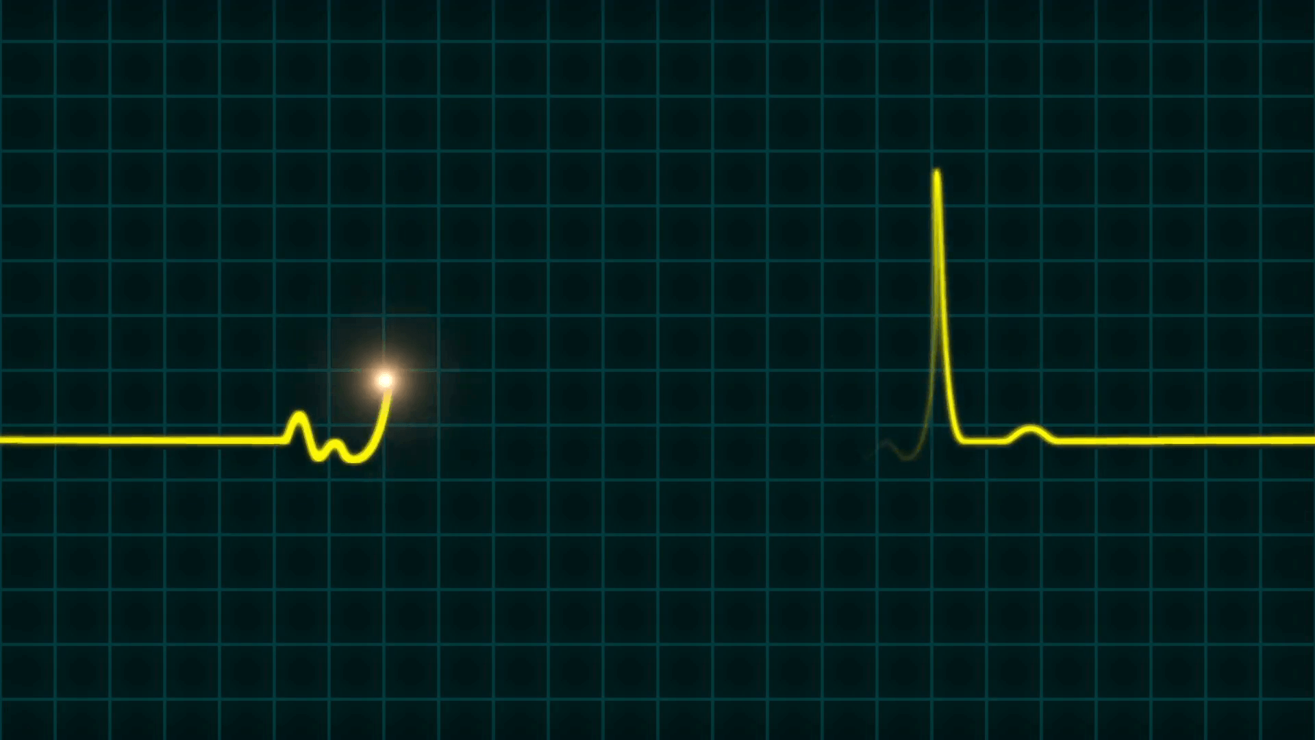 Heartbeat Wave Wallpapers