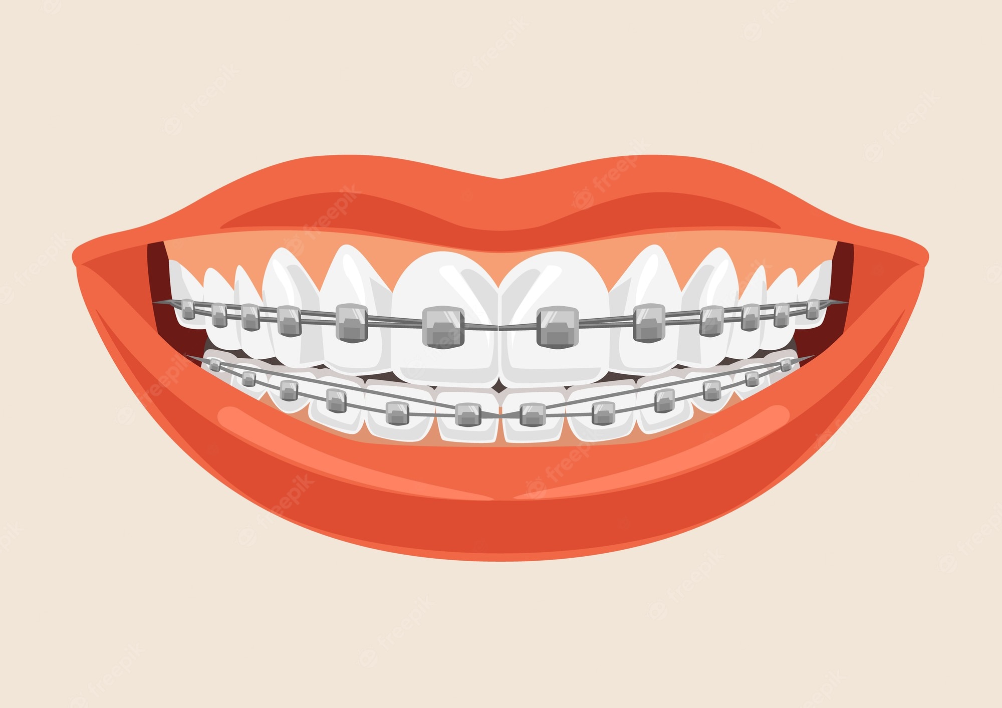 Braces Wallpapers