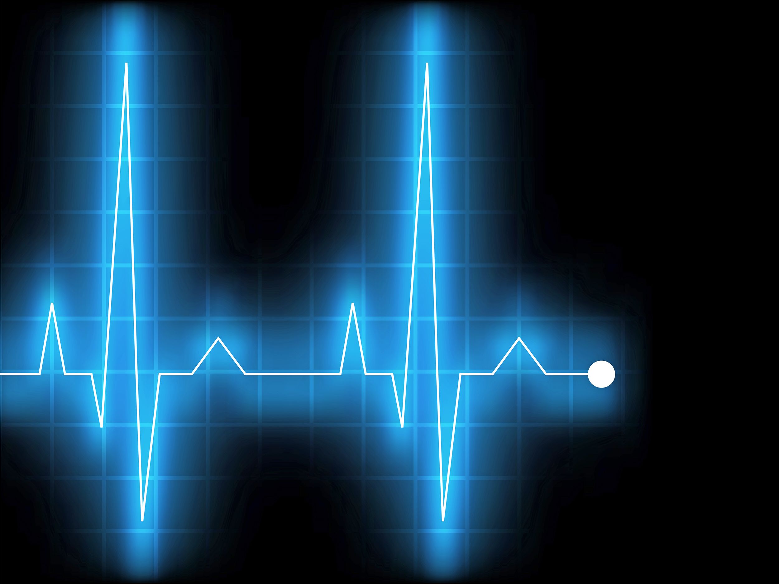 Ekg Wallpapers