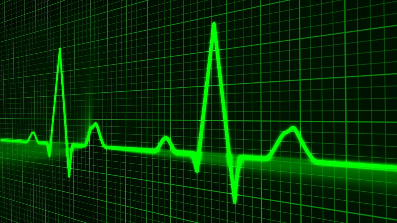 Ekg Wallpapers