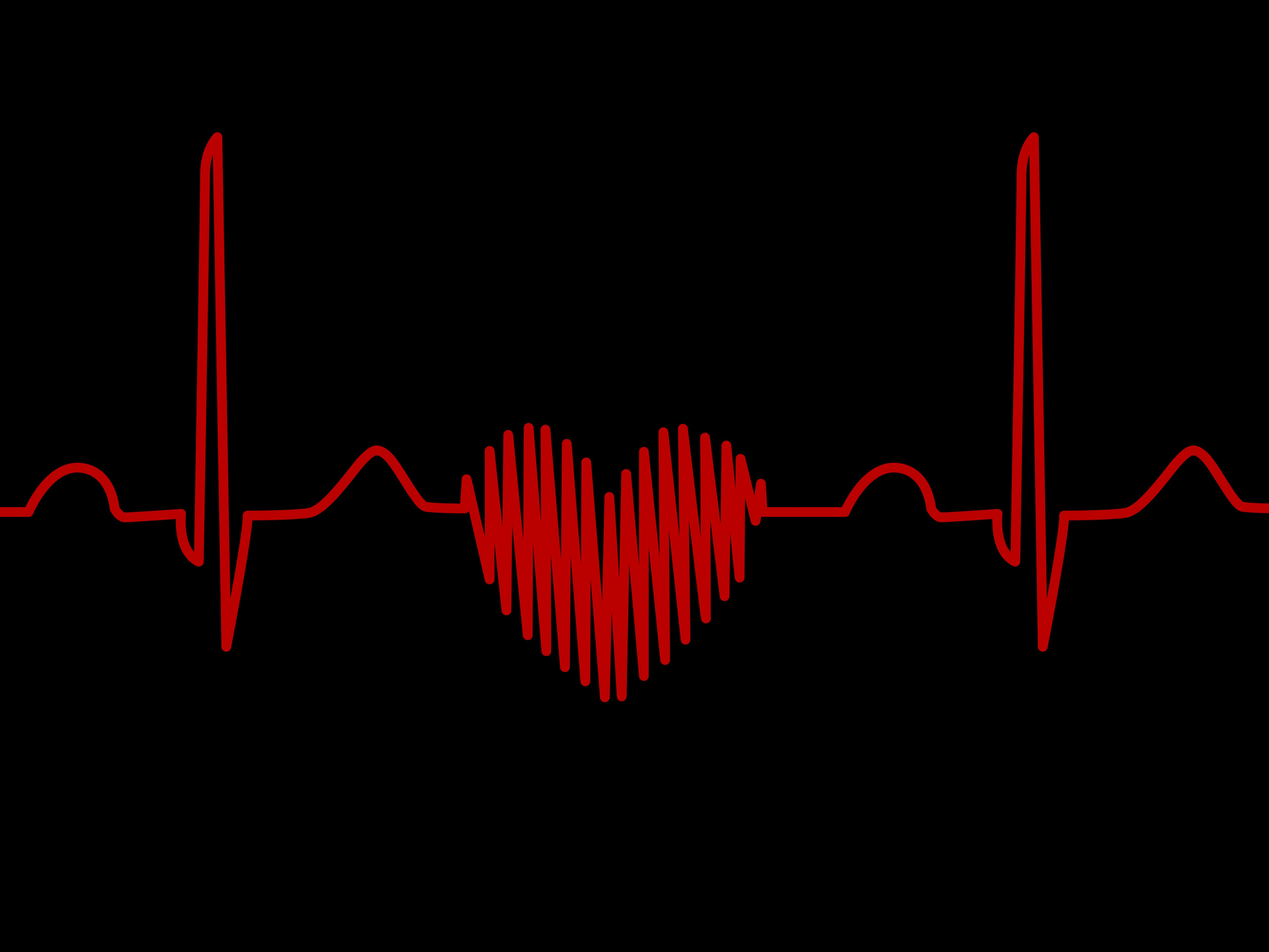 Ekg Wallpapers