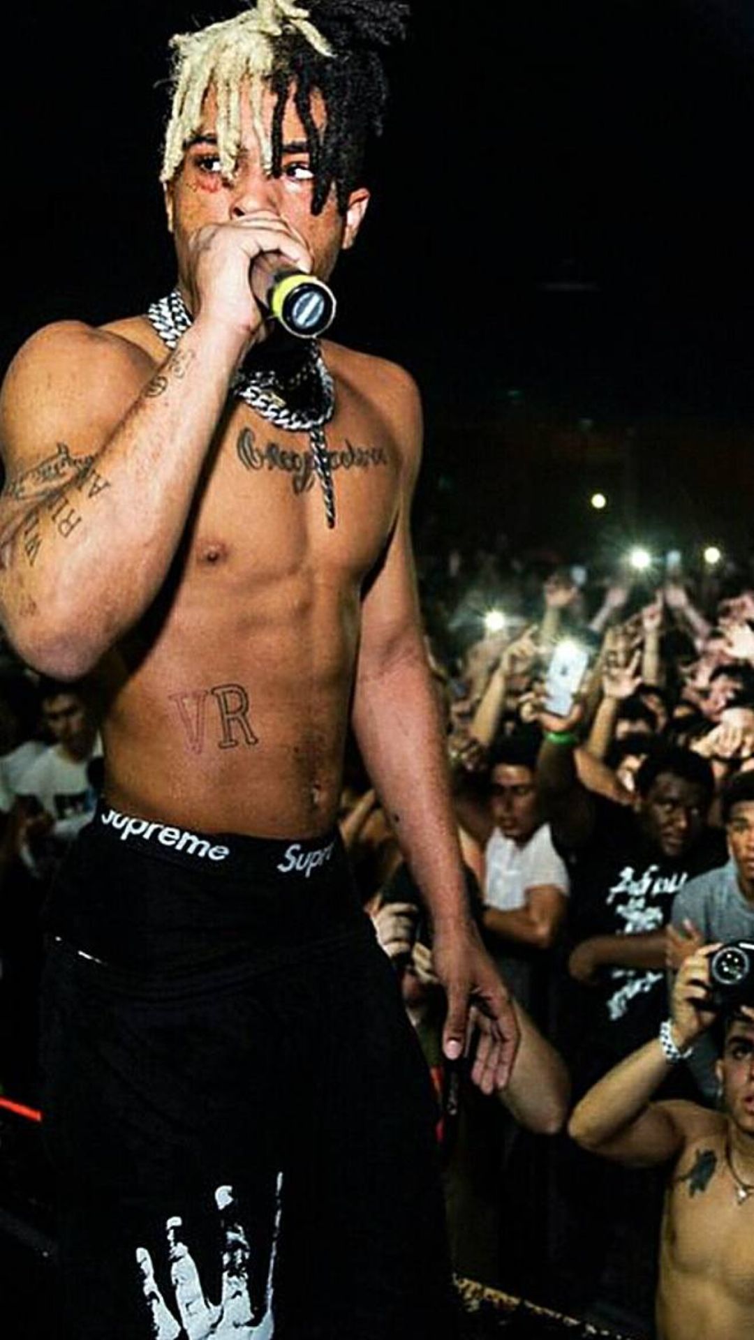 Xxxtentacion Rare Pics Wallpapers